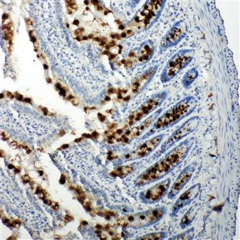 p107/RBL1 Rabbit Polyclonal Antibody