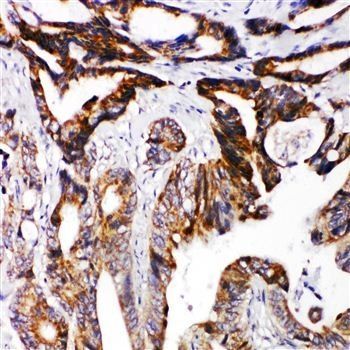 Netrin receptor DCC DCC Rabbit Polyclonal Antibody