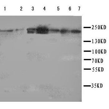 Netrin receptor DCC DCC Rabbit Polyclonal Antibody