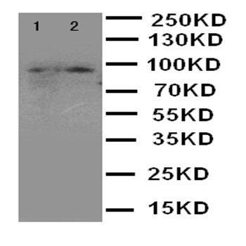 MALT1 Rabbit Polyclonal Antibody