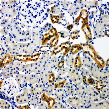 NADPH oxidase 4/NOX4 Rabbit Polyclonal Antibody