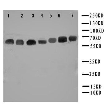 NADPH oxidase 4/NOX4 Rabbit Polyclonal Antibody