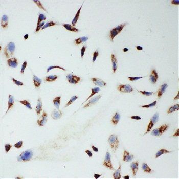 mtTFA/TFAM Rabbit Polyclonal Antibody
