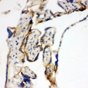mtTFA/TFAM Rabbit Polyclonal Antibody