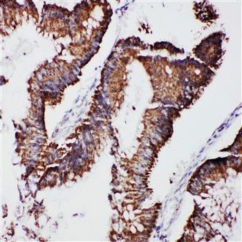 mtTFA/TFAM Rabbit Polyclonal Antibody