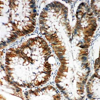 SQSTM1/p62 Rabbit Polyclonal Antibody