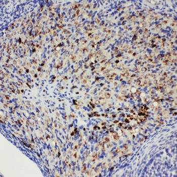 DDX4/MVH Rabbit Polyclonal Antibody