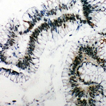 53BP1/TP53BP1 Rabbit Polyclonal Antibody