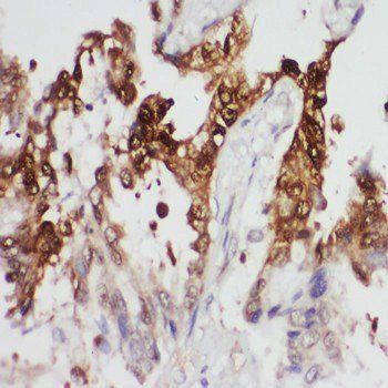 Phosphoglycerate kinase 1 PGK1 Rabbit Polyclonal Antibody