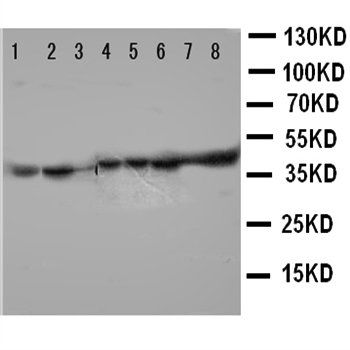 Phosphoglycerate kinase 1 PGK1 Rabbit Polyclonal Antibody
