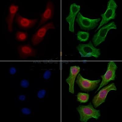 p53 Antibody