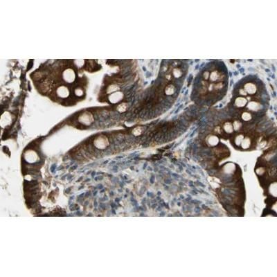 NMDAR1 Antibody