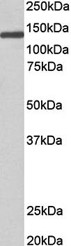 Goat anti-OSMR Antibody