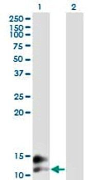 Osteocalcin Rabbit Polyclonal Antibody