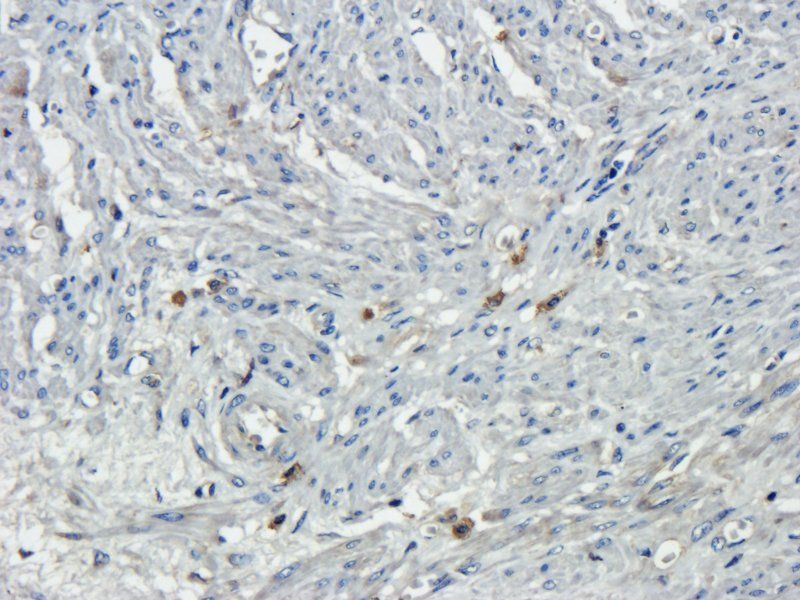 Osteocalcin Rabbit Polyclonal Antibody