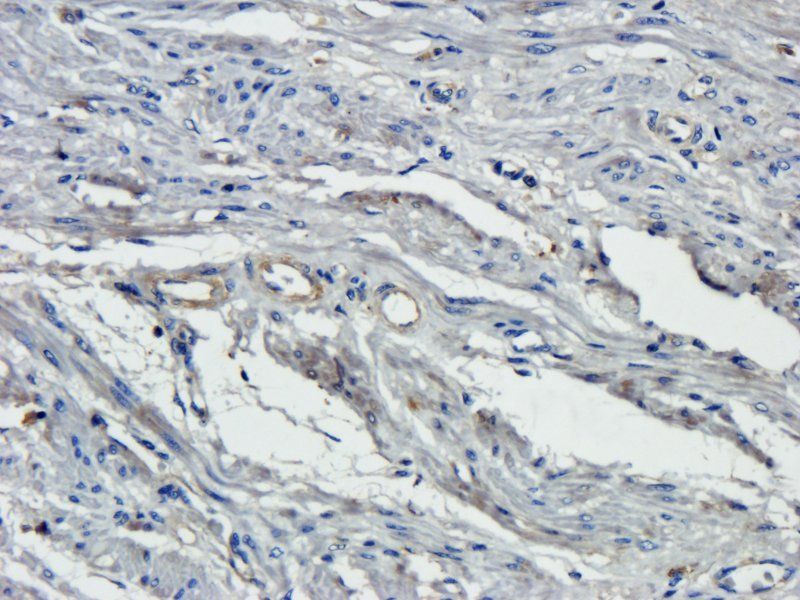 Osteocalcin Rabbit Polyclonal Antibody