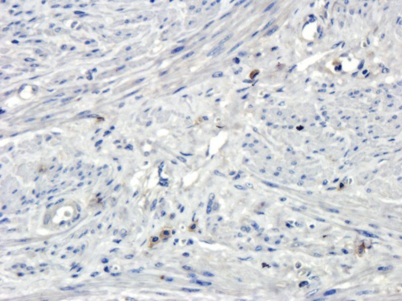 Osteocalcin Rabbit Polyclonal Antibody