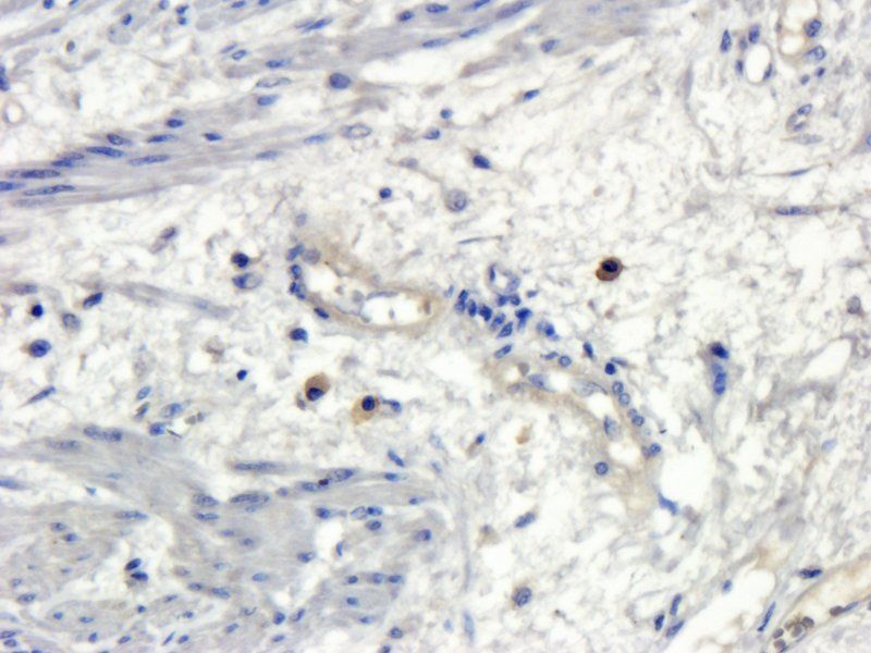 Osteocalcin Rabbit Polyclonal Antibody