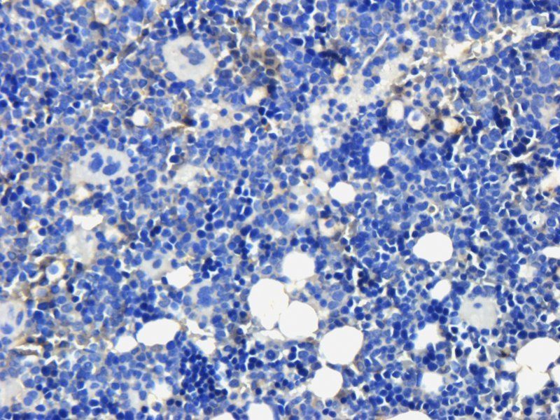 Osteocalcin Rabbit Polyclonal Antibody