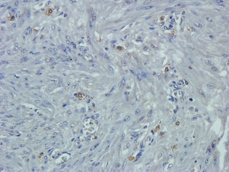 Osteocalcin Rabbit Polyclonal Antibody