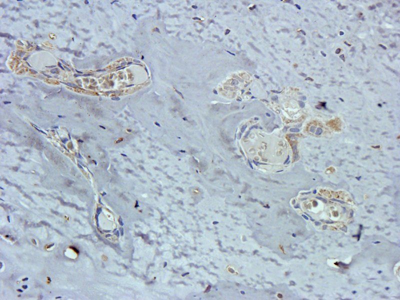 Osteocalcin Rabbit Polyclonal Antibody