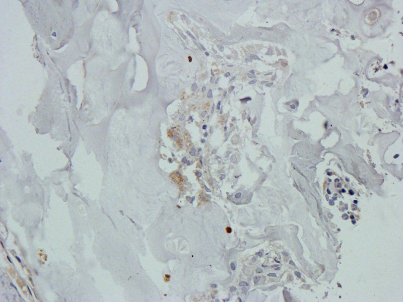 Osteocalcin Rabbit Polyclonal Antibody