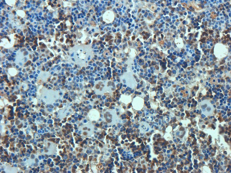 Osteocalcin Rabbit Polyclonal Antibody