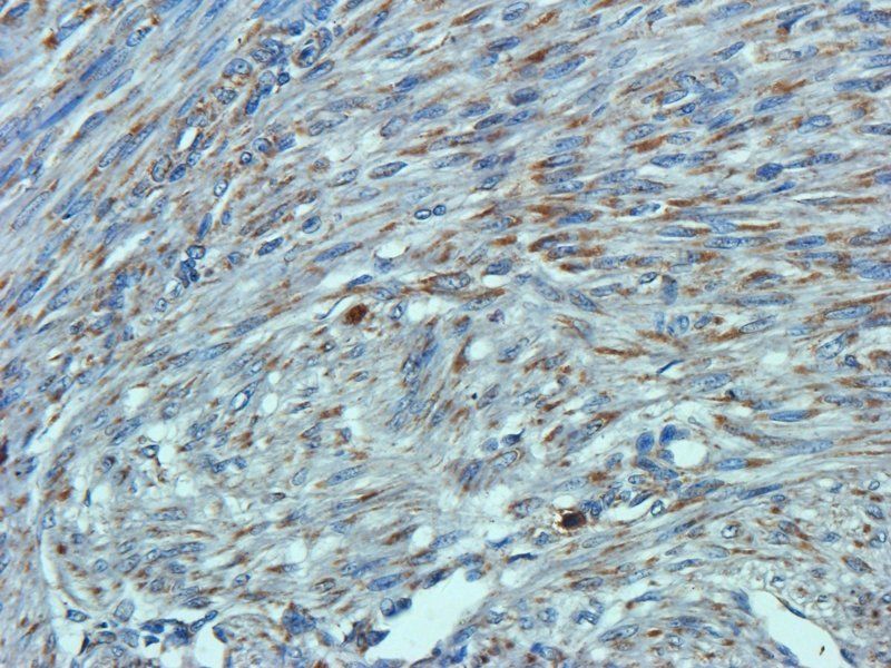 Osteocalcin Rabbit Polyclonal Antibody