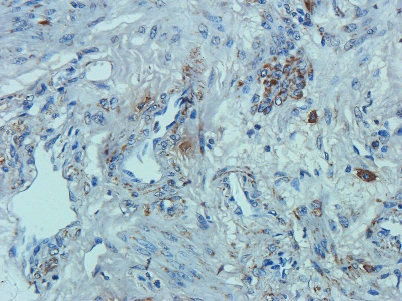 Osteocalcin Rabbit Polyclonal Antibody