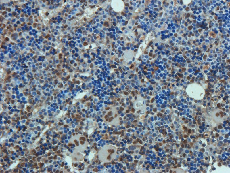 Osteocalcin Rabbit Polyclonal Antibody