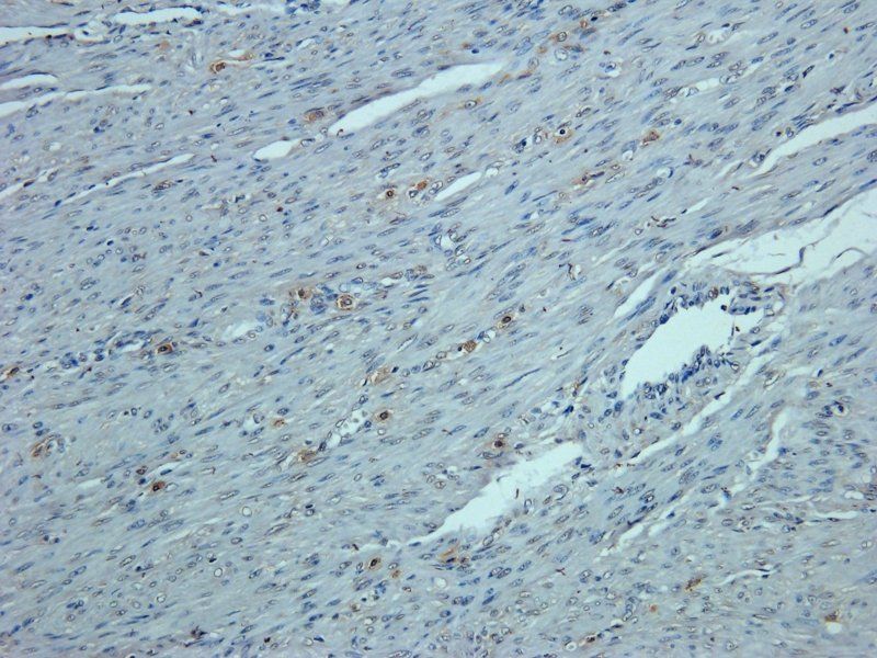 Osteocalcin Rabbit Polyclonal Antibody
