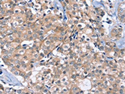 OTUB1 Antibody