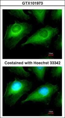 OTUB1 Rabbit Polyclonal Antibody