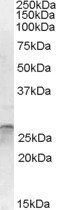 OTUB2 Antibody