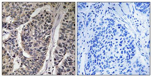 p130 Cas (Phospho-Tyr410) Antibody
