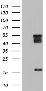 CDKN2C Antibody