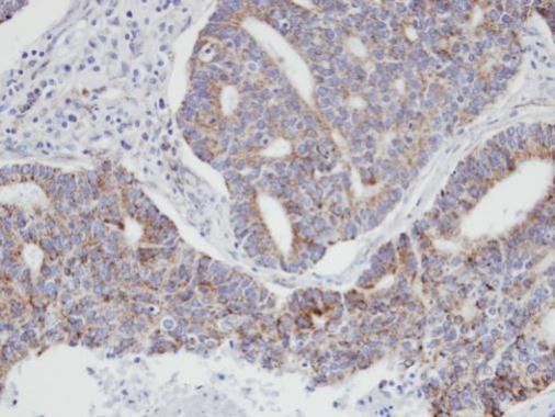 p21-ARC Rabbit Polyclonal Antibody