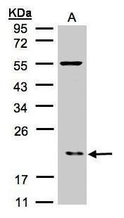 p21-ARC Rabbit Polyclonal Antibody