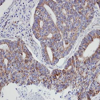 p21-ARC Rabbit Polyclonal Antibody