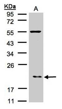 p21-ARC Rabbit Polyclonal Antibody