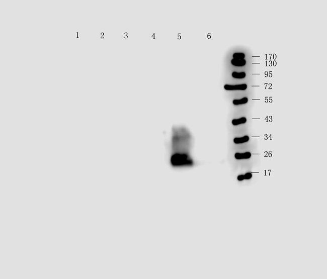 P2RX4 Rabbit Polyclonal Antibody