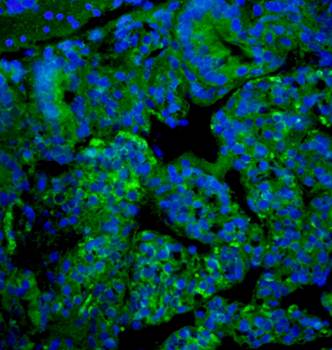 P2RX4 Rabbit Polyclonal Antibody (FITC)