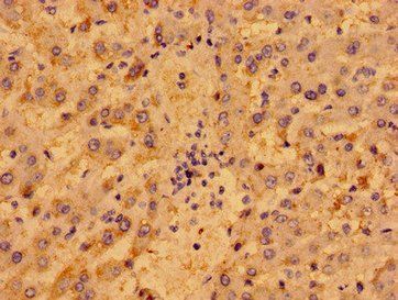 P2RY1 Antibody