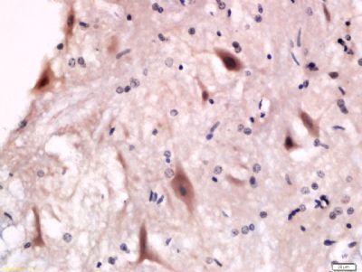 P2Y12 Rabbit Polyclonal Antibody