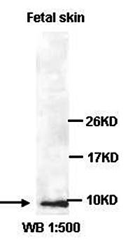P311 Rabbit Polyclonal Antibody