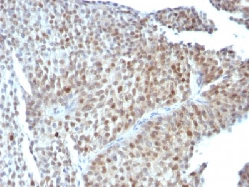 TP53 Antibody