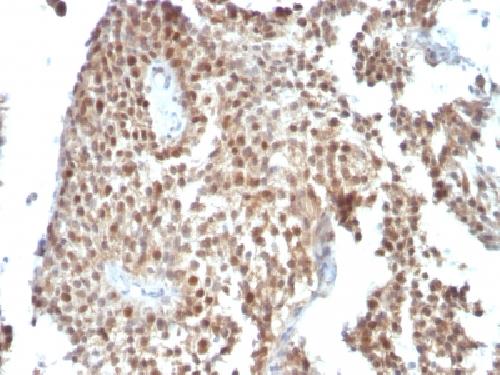 TP53 Antibody