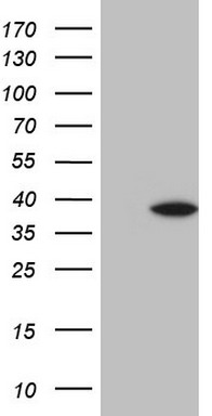 p53 Antibody