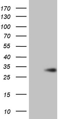 p53 Antibody
