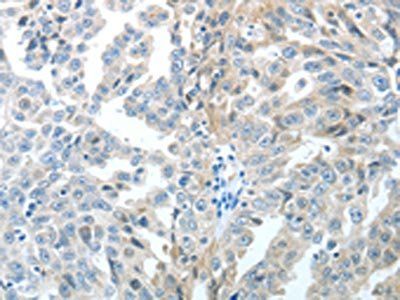 TP63 Antibody